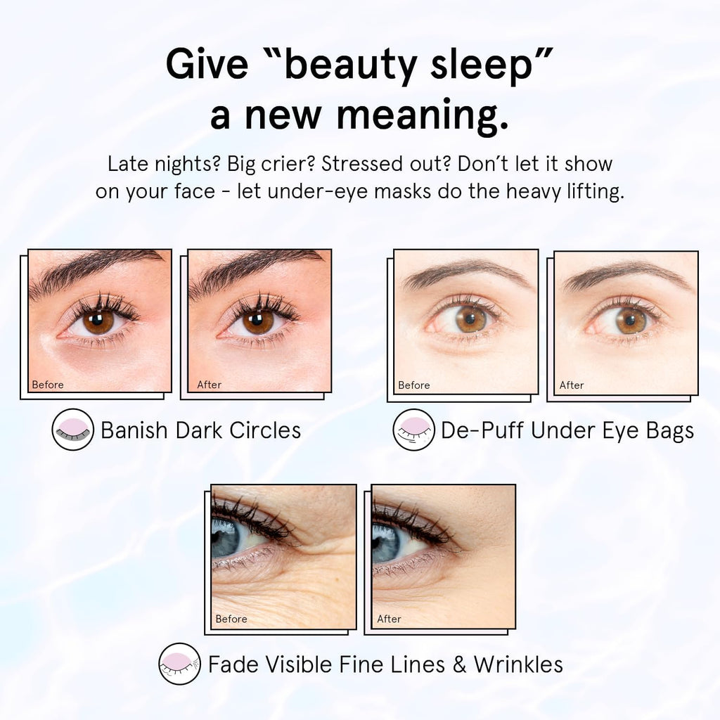 grace & stella Retinol Under Eye Patches for Puffy Eyes