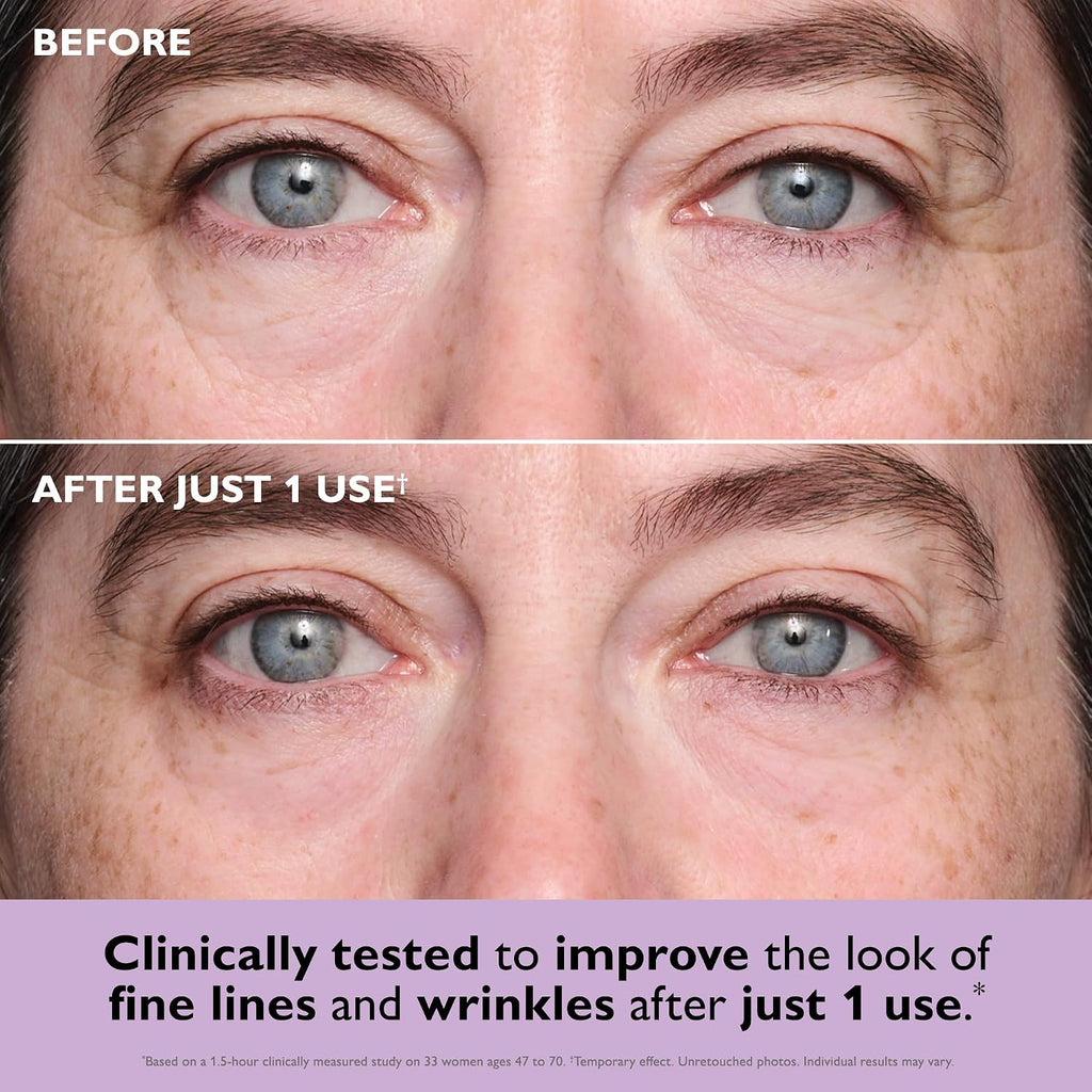 Peter Thomas Roth | Instant FIRMx® Collagen Tightening Eye Patches | Eye Patches For Firming Under-Eye Bags & Wrinkles | Eye Masks For Puffiness
